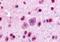 GLI Family Zinc Finger 2 antibody, orb86486, Biorbyt, Immunohistochemistry paraffin image 