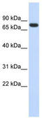 Ankyrin Repeat Domain 13B antibody, TA338824, Origene, Western Blot image 