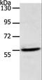 Acyl-CoA Thioesterase 2 antibody, LS-C403707, Lifespan Biosciences, Western Blot image 