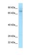 Melatonin Receptor 1B antibody, orb331264, Biorbyt, Western Blot image 