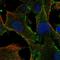 EPI64 protein antibody, HPA076041, Atlas Antibodies, Immunofluorescence image 