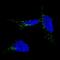 Tyrosinase Related Protein 1 antibody, NBP2-61142, Novus Biologicals, Immunocytochemistry image 