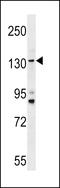 Transmembrane Channel Like 5 antibody, LS-C157206, Lifespan Biosciences, Western Blot image 