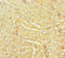 Neuroblastoma Amplified Sequence antibody, LS-C676120, Lifespan Biosciences, Immunohistochemistry paraffin image 