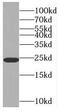 Ras-related protein Rab-6A antibody, FNab07041, FineTest, Western Blot image 