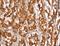 Perilipin 2 antibody, LS-C406223, Lifespan Biosciences, Immunohistochemistry frozen image 