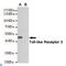 Toll Like Receptor 3 antibody, LS-C813135, Lifespan Biosciences, Western Blot image 