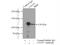 CCR4-NOT Transcription Complex Subunit 3 antibody, 11135-1-AP, Proteintech Group, Immunoprecipitation image 