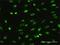 MAGE Family Member A2B antibody, H00004101-M02, Novus Biologicals, Immunofluorescence image 