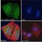 Transient Receptor Potential Cation Channel Subfamily M Member 7 antibody, LS-C55632, Lifespan Biosciences, Immunofluorescence image 