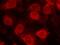 Eukaryotic Translation Initiation Factor 4E antibody, GTX50268, GeneTex, Immunofluorescence image 