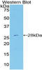 DExD/H-Box Helicase 58 antibody, LS-C296231, Lifespan Biosciences, Western Blot image 