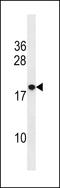 Ring Finger Protein 24 antibody, LS-C158875, Lifespan Biosciences, Western Blot image 