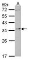 Pyrroline-5-Carboxylate Reductase 1 antibody, NBP2-20016, Novus Biologicals, Western Blot image 