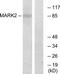Microtubule Affinity Regulating Kinase 2 antibody, TA313814, Origene, Western Blot image 