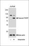 Poly(ADP-Ribose) Polymerase 1 antibody, 61-315, ProSci, Western Blot image 