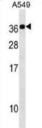 Calcium Binding Protein 2 antibody, abx030811, Abbexa, Western Blot image 