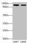 Exostosin Like Glycosyltransferase 3 antibody, CSB-PA03075A0Rb, Cusabio, Western Blot image 