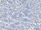 CD14 antibody, A00137-2, Boster Biological Technology, Immunohistochemistry paraffin image 