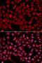 Siah E3 Ubiquitin Protein Ligase 1 antibody, LS-C332116, Lifespan Biosciences, Immunofluorescence image 