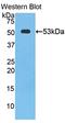 Cathepsin K antibody, LS-C293259, Lifespan Biosciences, Western Blot image 