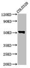 WASP antibody, CSB-PA025967LA01HU, Cusabio, Western Blot image 