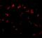 Sprouty Related EVH1 Domain Containing 1 antibody, NBP2-81927, Novus Biologicals, Immunofluorescence image 