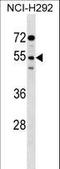 Signal Regulatory Protein Gamma antibody, LS-C161101, Lifespan Biosciences, Western Blot image 