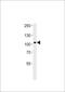 Neurotrophic Receptor Tyrosine Kinase 3 antibody, 63-145, ProSci, Western Blot image 