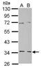 Geranylgeranyl Diphosphate Synthase 1 antibody, PA5-28470, Invitrogen Antibodies, Western Blot image 
