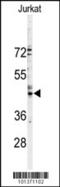 Gap Junction Protein Alpha 3 antibody, 58-175, ProSci, Western Blot image 