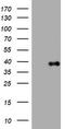 Phosphatidylinositol-4-Phosphate 3-Kinase Catalytic Subunit Type 2 Alpha antibody, CF801639, Origene, Western Blot image 
