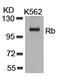 RB Transcriptional Corepressor 1 antibody, 79-322, ProSci, Western Blot image 