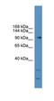 Glutamate Metabotropic Receptor 7 antibody, orb331055, Biorbyt, Western Blot image 