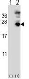 Microfibril Associated Protein 5 antibody, GTX81533, GeneTex, Western Blot image 