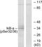 NFKB Inhibitor Alpha antibody, LS-C199097, Lifespan Biosciences, Western Blot image 