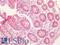 FAS antibody, LS-B7630, Lifespan Biosciences, Immunohistochemistry paraffin image 