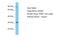 Alpha And Gamma Adaptin Binding Protein antibody, A07058, Boster Biological Technology, Western Blot image 