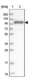 Exocyst Complex Component 1 antibody, PA5-58071, Invitrogen Antibodies, Western Blot image 