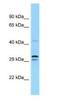 Ubiquitin Like Modifier Activating Enzyme 5 antibody, NBP1-98392, Novus Biologicals, Western Blot image 