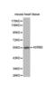 Adrenoceptor Beta 2 antibody, abx001665, Abbexa, Western Blot image 