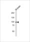 ADAM Metallopeptidase With Thrombospondin Type 1 Motif 4 antibody, LS-C100640, Lifespan Biosciences, Western Blot image 