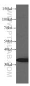 Thiosulfate Sulfurtransferase antibody, 66018-1-Ig, Proteintech Group, Western Blot image 