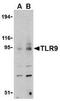 Toll-like receptor 9 antibody, NBP1-77254, Novus Biologicals, Western Blot image 