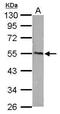 Calcium/Calmodulin Dependent Protein Kinase IG antibody, PA5-34711, Invitrogen Antibodies, Western Blot image 