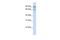 Mitogen-Activated Protein Kinase Kinase Kinase Kinase 2 antibody, PA5-43202, Invitrogen Antibodies, Western Blot image 