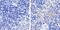 FOXP3 antibody, 700914, Invitrogen Antibodies, Immunohistochemistry paraffin image 