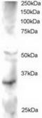 FRAT Regulator Of WNT Signaling Pathway 2 antibody, TA302774, Origene, Western Blot image 