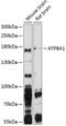 ATPase Phospholipid Transporting 8A1 antibody, 19-049, ProSci, Western Blot image 