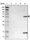 Phosphatidylinositol Glycan Anchor Biosynthesis Class S antibody, PA5-53739, Invitrogen Antibodies, Western Blot image 